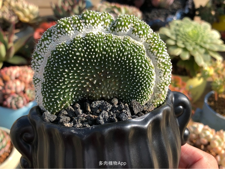 beat·365|少女月经不调 该不该做妇科检查?