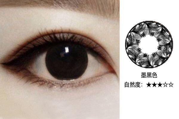 宫颈糜烂的4种类型：beat365亚洲体育官方网站