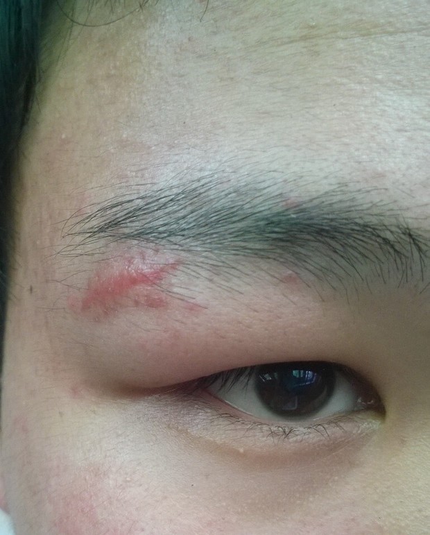 霉菌型阴道炎的中医疗法‘beat365亚洲体育官方网站’